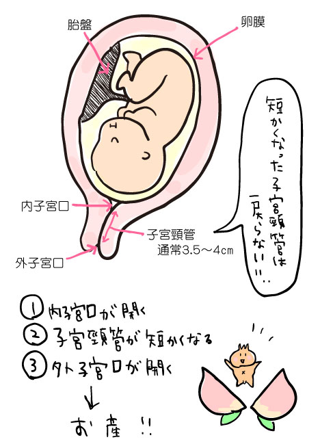 切迫早産の仕組み